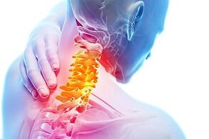 Simptomele osteochondrozei cervicale și regulilor de nutriție pentru boli