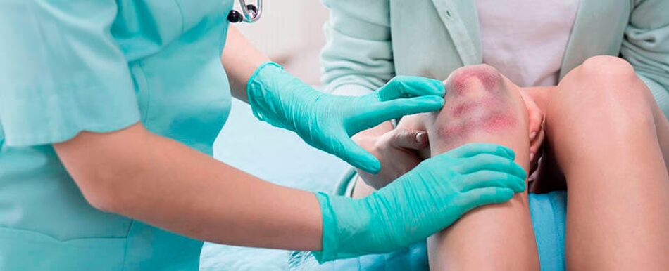 un medic examinează o leziune la genunchi