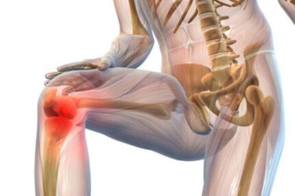 artroza deformatoare a articulației genunchiului drept tratarea cu laser a genunchiului în artroză