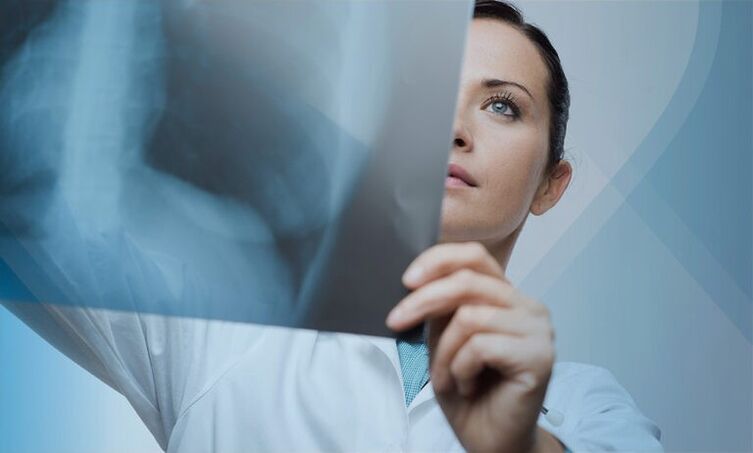 un medic examinează un instantaneu al coloanei cervicale cu osteocondroză