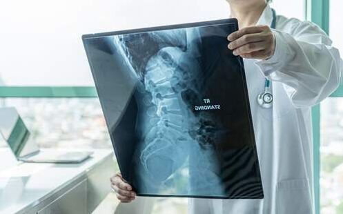Radiografia este o metodă de diagnostic necesară dacă doare spatele